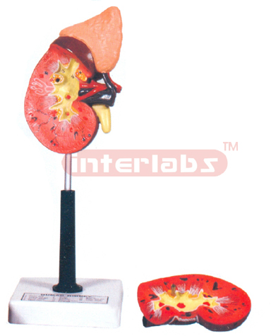 HUMAN KIDNEY WITH ADRENAL GLAND